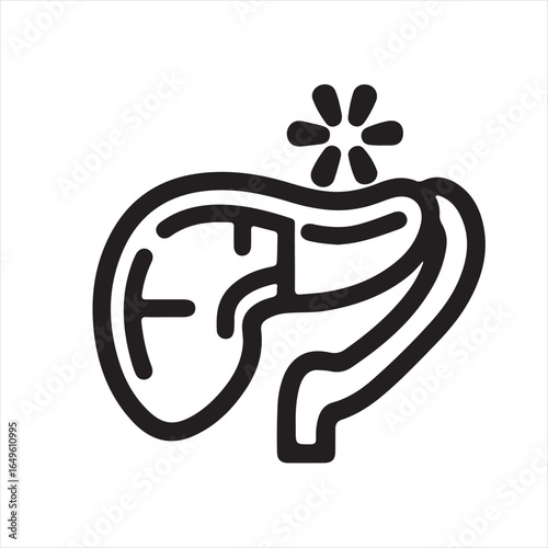 Inflamed Pancreas Icon: Medical Illustration of Pancreatitis. This medical illustration depicts an inflamed pancreas, highlighting the organ s anatomy and the area of inflammation.