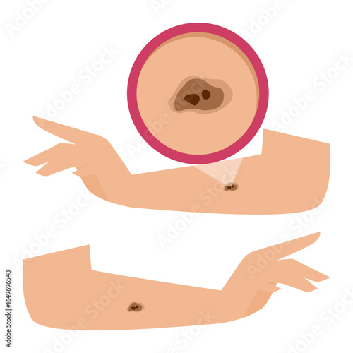 Hands of a young woman with melanoma under magnification