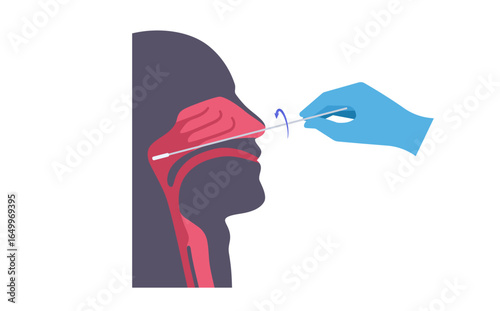Nasopharyngeal swab procedure
