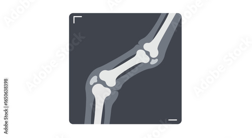 Vector graphic of a human bone joint X-ray. Medical imaging concept for healthcare, rheumatology, and diagnostics.