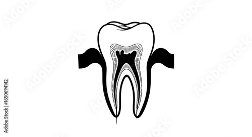 Illustration of a tooth with a cavity and root canal shown in black and white detail drawing style