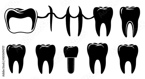 Illustration showing different types of teeth including a bridge and an implant in black and white