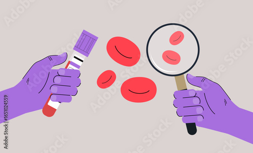 Blood Sample Analysis Under Magnification. Hands in purple gloves hold a blood collection tube and a magnifying glass, focused on red blood cells.
