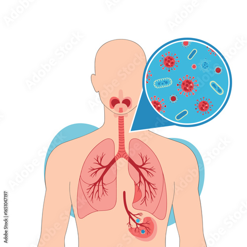 Understanding respiratory infections and how they affect your lungs and body health