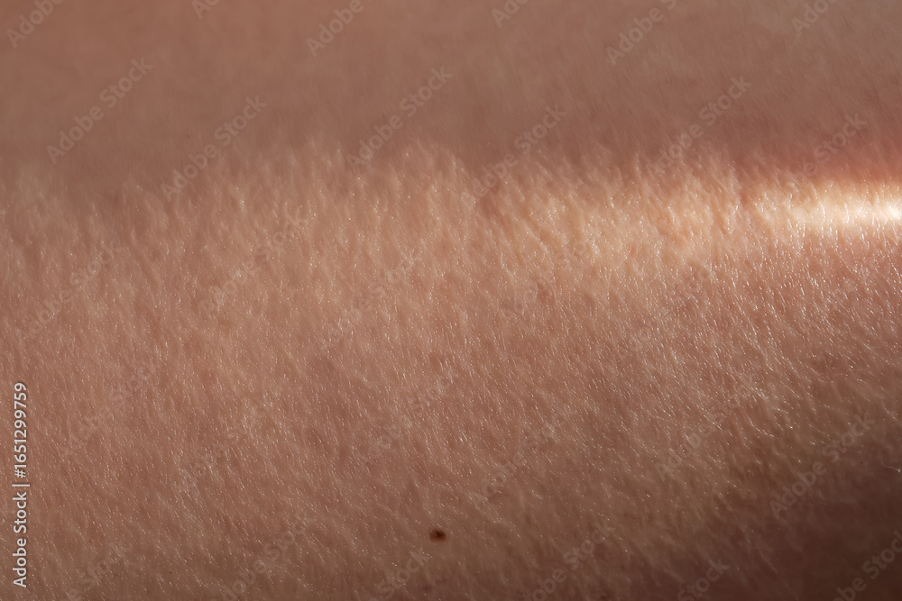 Fototapeta premium The texture of the skin with a ray of sunshine on it.