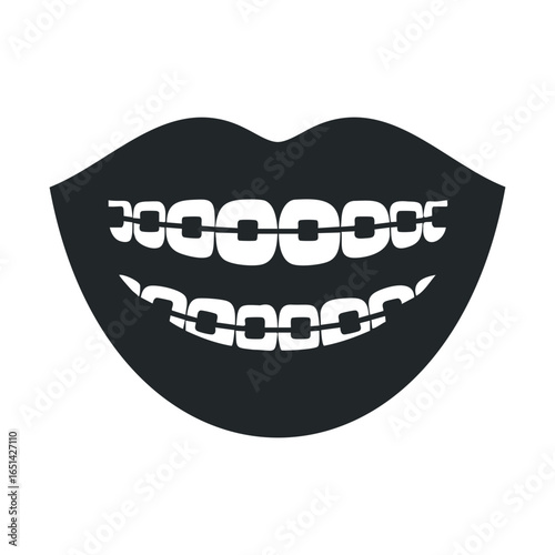 Graphic illustration of smiling mouth with braces on teeth