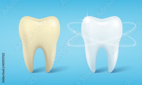 Vector Banner with Realistic Dirty and Clean Tooth. Cleaning Concept, Before, After Hygienic Teeth Cleaning. Dentistry Design for Medical, Toothpaste Advertisement. Healthy Oral Hygiene, Teeth Care