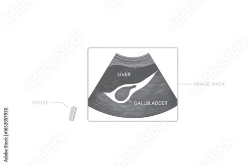 Vector ultrasound scan image highlighting liver and gallbladder anatomy with contrast shape, used in diagnostic and educational visuals.