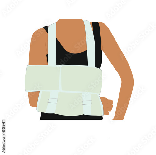 Woman with broken arm. broken arm in bandage