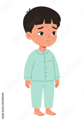 A child with chickenpox stands in his pajamas and looks sad.