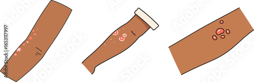 Illustrations of skin conditions on brown arms in flat style  