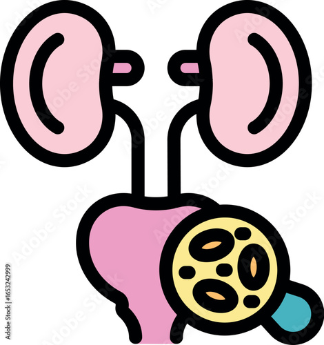 Magnifying glass showing kidney stones, focusing on urinary system health and the importance of urological checkups