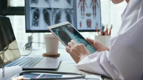 radiologist analyzing CT scan of a patient's lungs in hospital office. doctor medical examining x-ray of patient lungs on digital tablet screen, closeup.