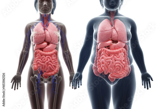 Comparison of human anatomy, showing digestive system differences between thin and obese figures.