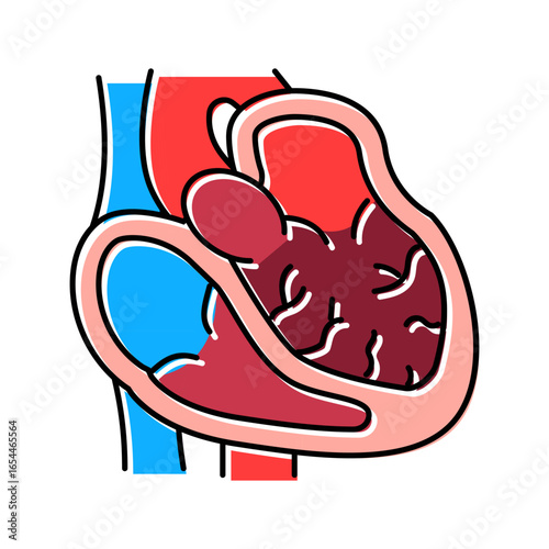 dilated cardiomyopathy cardiology disease color icon vector illustration