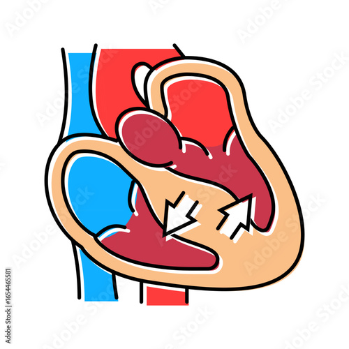 hypertrophic cardiomyopathy cardiology color icon vector illustration