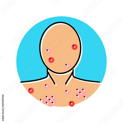 acne adolescence puberty color icon vector illustration