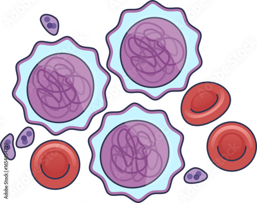 Illustration of leukemia cells (blasts) in the bloodstream with red blood cells and platelets. Depicts blood cancer and abnormal cell proliferation.