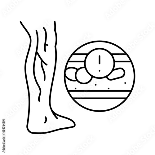 deep vein thrombosis cardiology disease line icon vector illustration