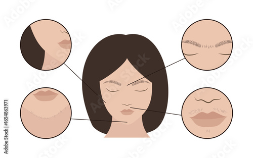 Woman face showing areas for epilation and hair removal