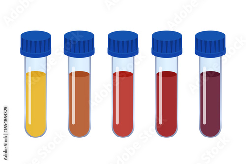 Five test tubes containing different colored liquids are displayed