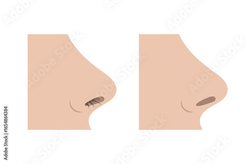 Nose hair removal before and after, clean nose without hair