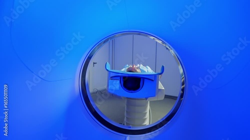 CT scanning of the spine examination for assess for herniated disk, tumors, extent of injuries, blood vessel malformations. Video computed tomography CT scan process for examination of spine.