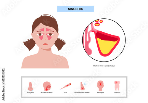Sinusitis medical poster