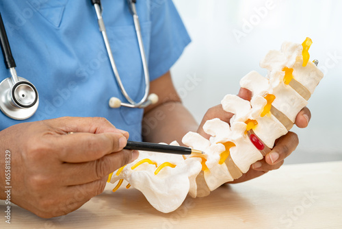 Принти на полотні Doctor with lumbar vertebra bone skeleton and nerve model for treatment in the orthopedic department