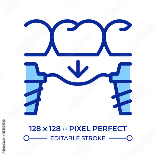 Tooth replacement pixel perfect line color icon. Dental implant, orthodontic service. Porcelain bridge, treatment. Isolated vector illustration. Flat colorful symbol design. Editable stroke