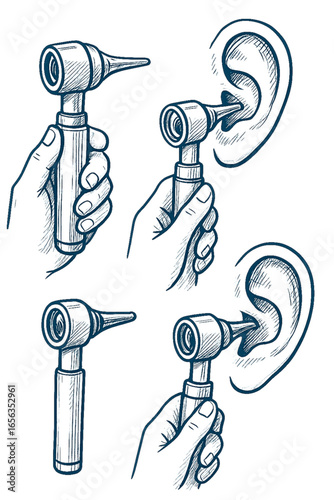 Illustration showing the use of an otoscope for ear examination in four stages.