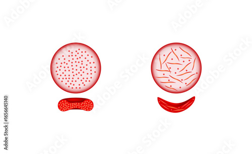 Sickle cell disease. Normal blood and Sickle cell anemia. Gene mutation. Vector illustration.	