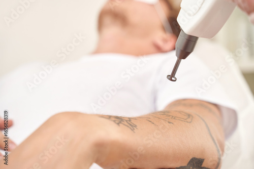 Young caucasian male receiving tattoo removal procedure with laser device in clinical setting.