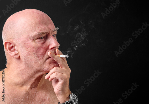 Middle aged man smoking a cigarette,as thick unhealthy smoke flows from his mouth,England,United Kingdom.