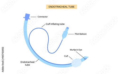 endotracheal intubation tube