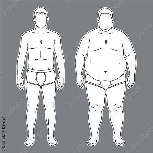 Male Body Type Comparison: Normal Weight vs Obese (Front, Line Art)
