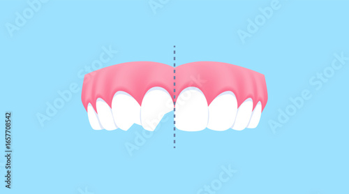 Upper teeth - Chipped (Before and After Comparison) illustration vector design. Dental care concept.