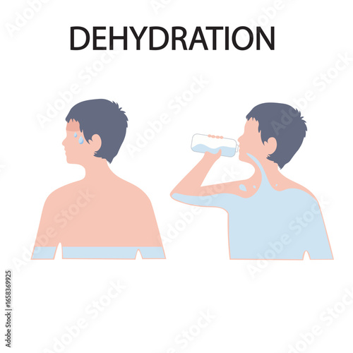 Dehydration vector illustration showing dry mouth, dizziness, fatigue, dark urine, rapid heartbeat; highlights symptoms similar to heatstroke, flu, and food poisoning.water