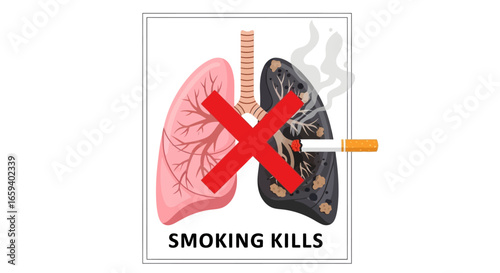 Visual warning: contrasting healthy versus diseased lungs affected by smoking, a poignant illustration of pulmonary consequences and health advocacy