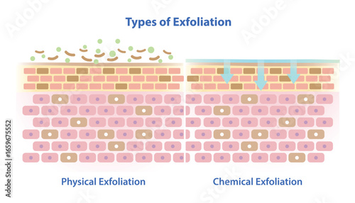 Types of exfoliation vector illustration on white background. Comparison of physical using scrubs, granules, beads, tools and chemical exfoliation using acids or enzymes. Skin care and beauty concept.