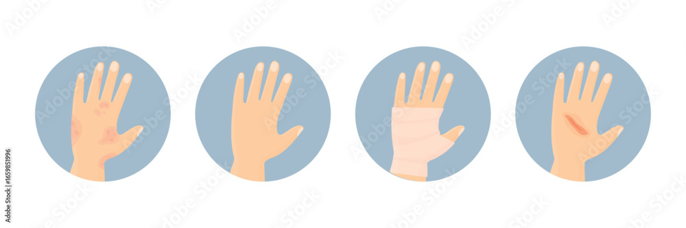 Obraz premium Various hand injuries. Psoriasis, fracture, cut and healthy hand. Hand skin problems.