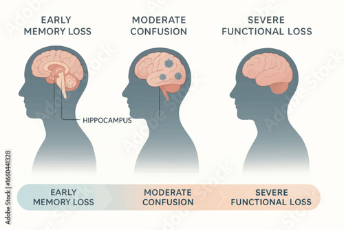 Vector infographic showing stages of cognitive decline with human silhouettes and brain function changes from memory loss to severe impairment.
