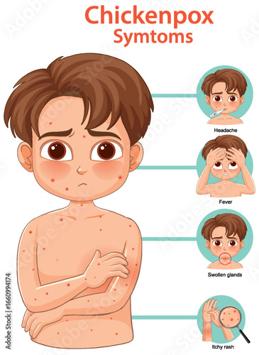 Chickenpox Symptoms in Children Illustrated Infographic