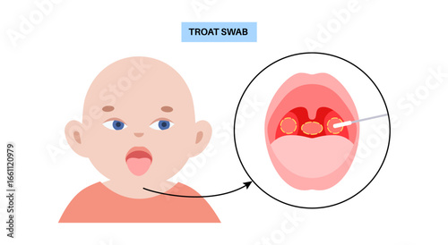 Swab throat procedure
