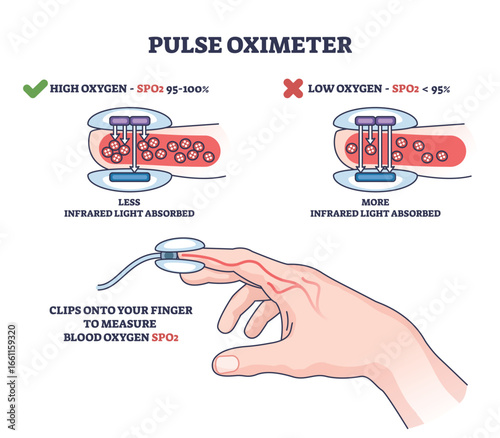 Pulse oximeter diagram shows how a fingertip device measures blood oxygen levels using light absorption. Key objects, finger, sensor, blood vessel. Outline diagram