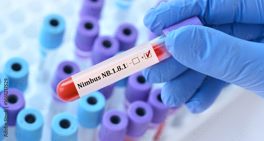 Obraz premium Doctor in protective uniform holding a blood test tube labeled Nimbus NB.1.8.1 with background of laboratory test tubes, symbolizing analysis of new dangerous coronavirus strain with severe symptoms