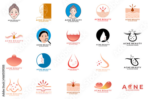 Set of Acne logo design vector template. Acne Skin care logo template