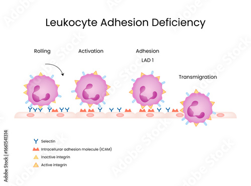 Leukocyte Adhesion Deficiency Process Rolling Activation Adhesion Transmigration
