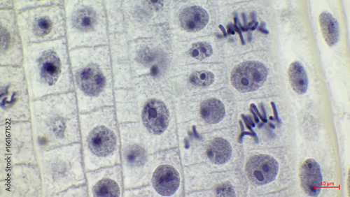Cuadro en lienzo Onion root tip mitosis under light microscope