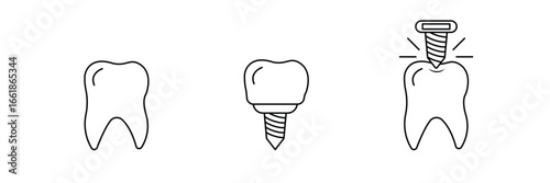 Dental care implant, tooth prosthetics treatment, oral hygiene health, dentist equipment symbol, medical surgery procedure outline, stomatology clinic icon vector illustration.